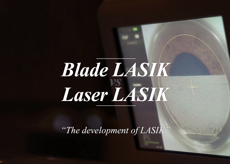 Blade LASIK vs Laser LASIK The development of LASIK