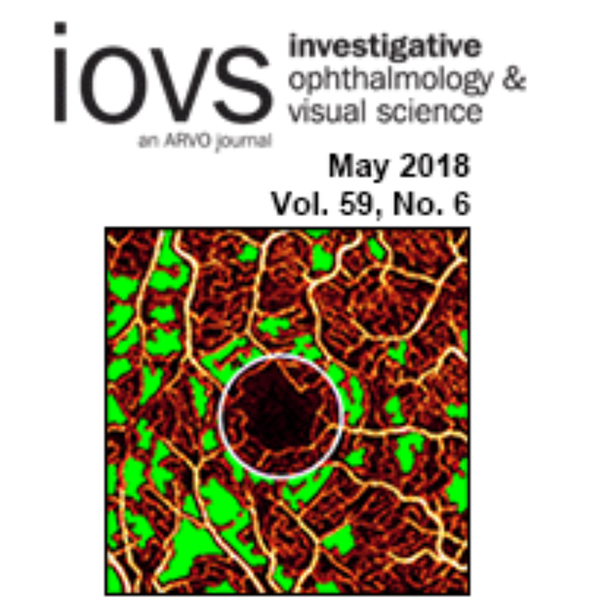 [논문] 로우에너지 스마일라식 센트레이션 연구논문, SCI 학술지  iOVS 등재 