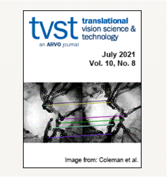 [Paper]Comparison of Clinical and Biomechanical Outcomes of Small Incision Lenticule Extraction With 120μm and 140μm Cap Thickness