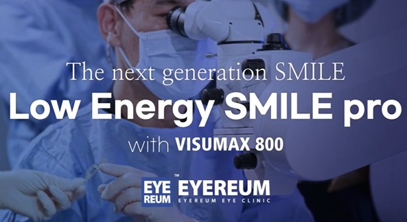 SMILE pro surgery  with the VisuMax 800 