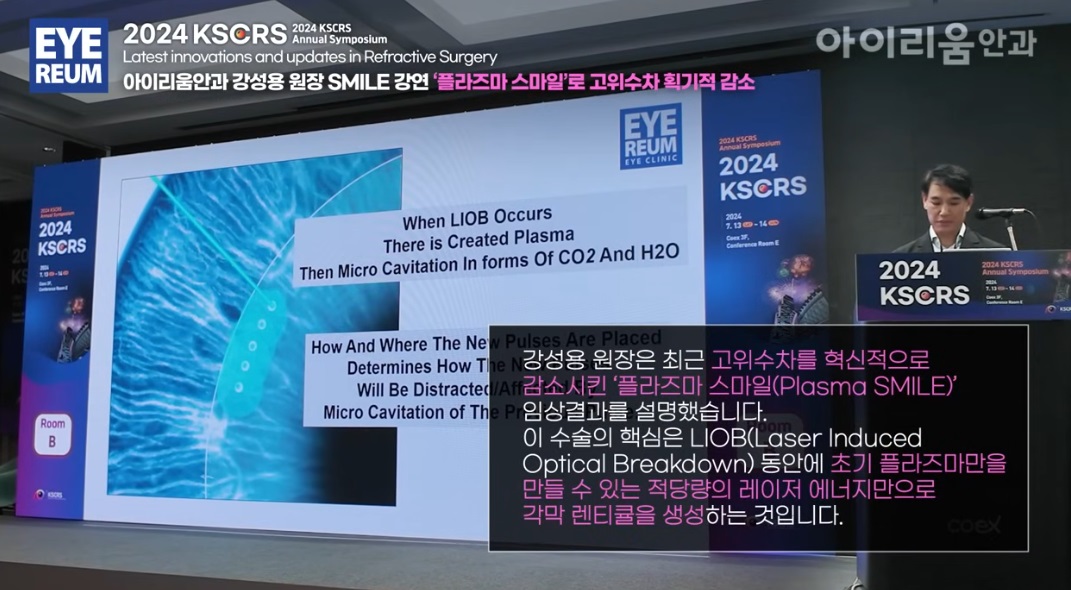 2024 KSCRS 'Latest Innovations and updates in Refractive Surgery' -Plasma SMILE Surgery