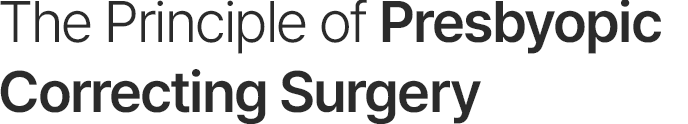 The Principle of Presbyopic Correcting Surgery