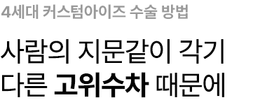 4세대 커스텀아이즈 수술 방법 - 사람의 지문같이  각기 다른 고위수차 때문에